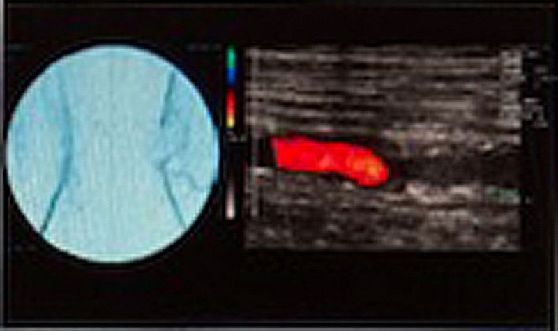 dr-hertel-angiologie-04